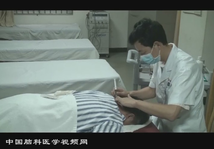 小针刀治疗外伤性头痛